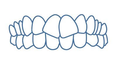 Alinhamento geral dos dentes