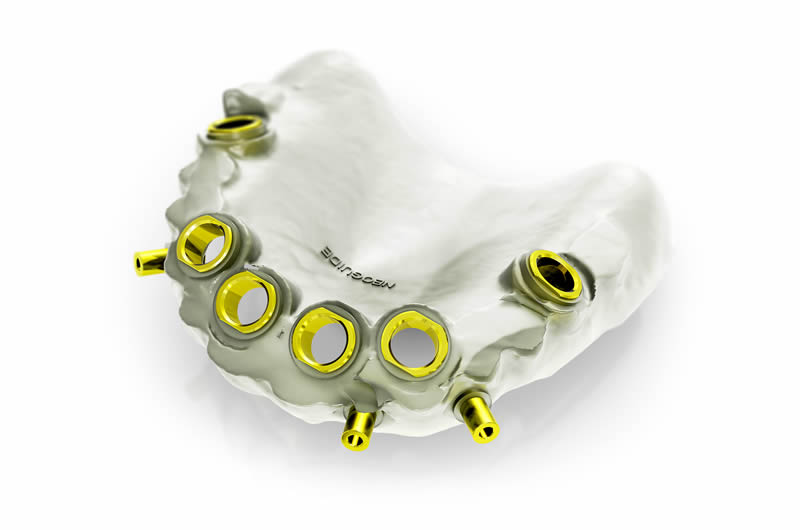 Guia Cirúrgica Prototipada